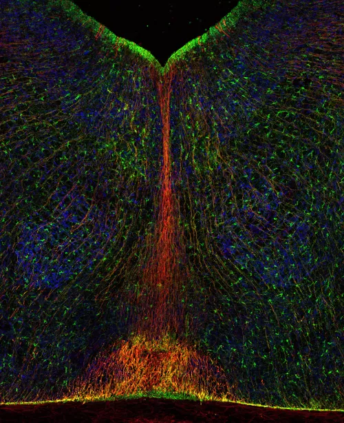 Neural stem cells