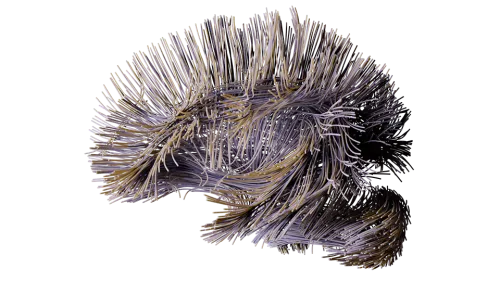 3D render of white matter tracts