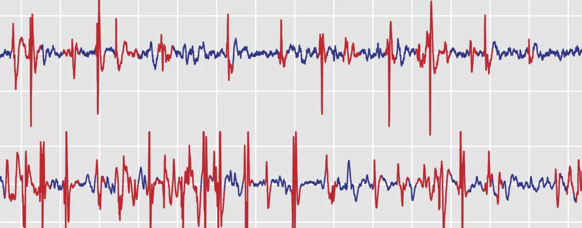 Baud, M.O., Kleen, J.K., Mirro, E.A. et al. Multi-day rhythms modulate seizure risk in epilepsy. Nat Commun 9, 88 (2018). https://doi.org/10.1038/s41467-017-02577-y