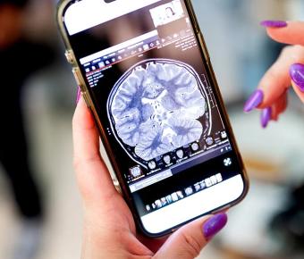 Close-up of hands holding a smartphone displaying a brain MRI scan on the screen