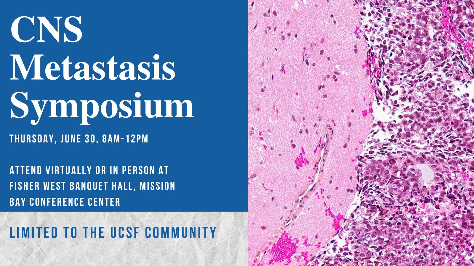 CNS Metastasis Symposium, Thursday, June 30, 8am-12pm, Attend virtually or in person at Fischer West Banquet Hall, Mission Bay Conference Center, Limited to the UCSF Community