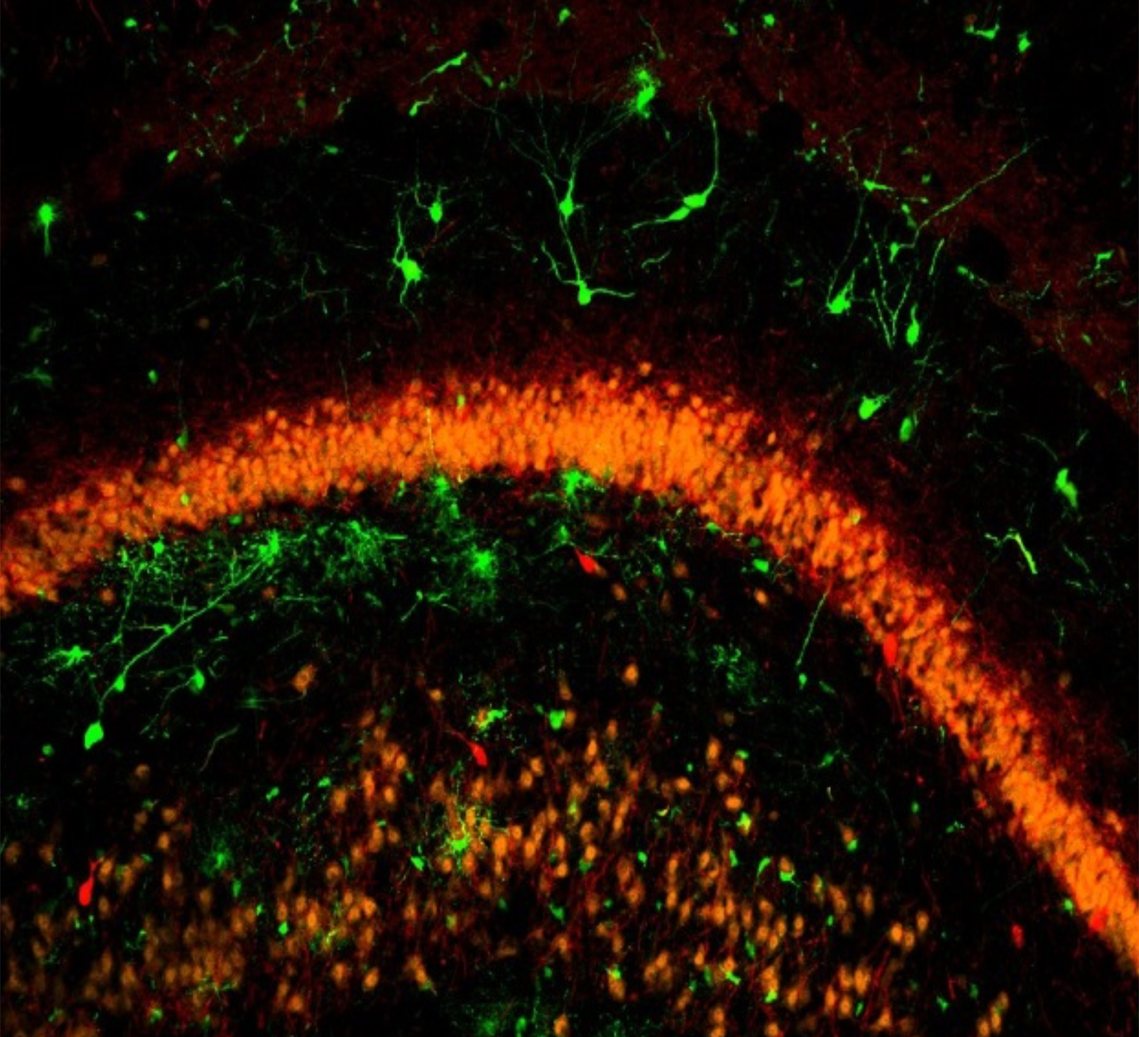 Pig embryonic medial ganglionic cells transplanted into mouse hippocampus. Photo by Mariana Casalia, PhD. 