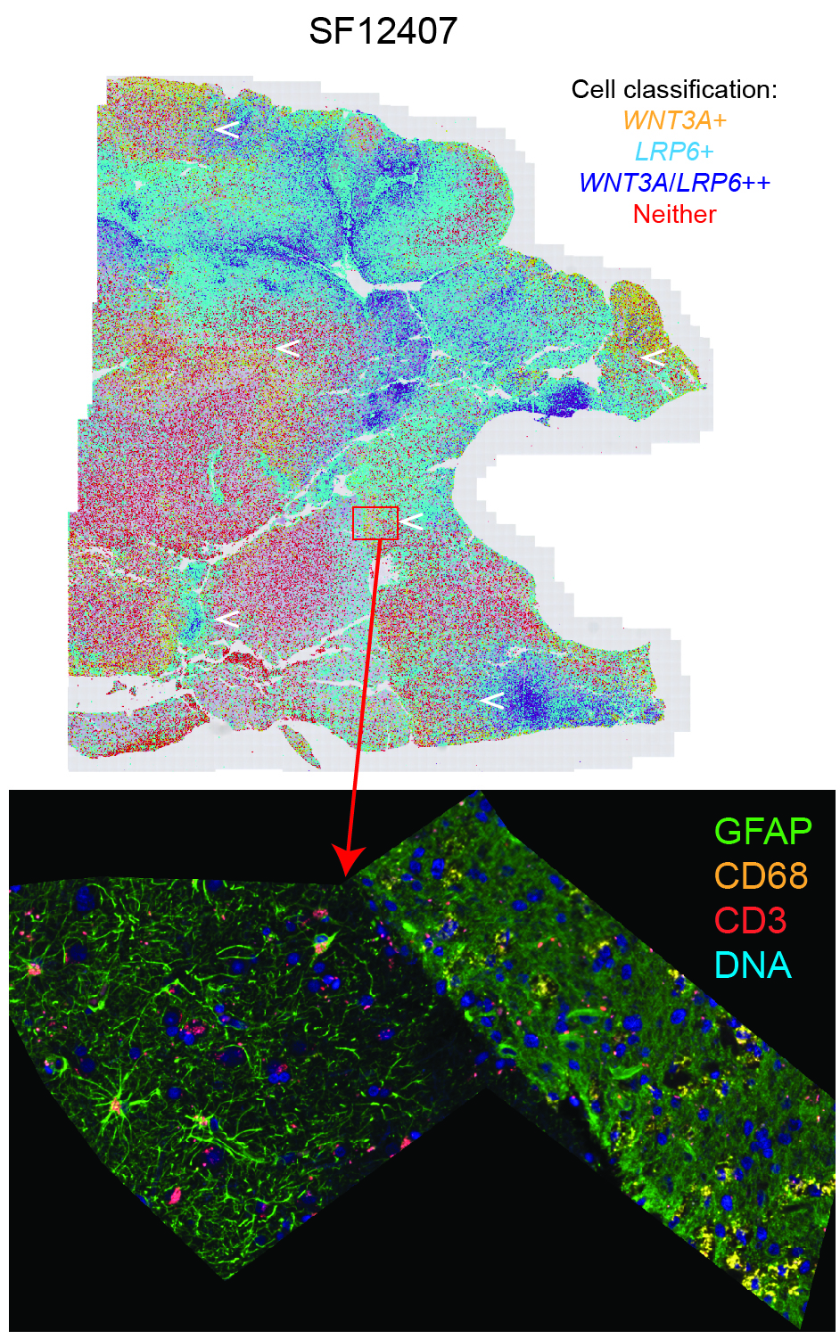 spatial transciptomics