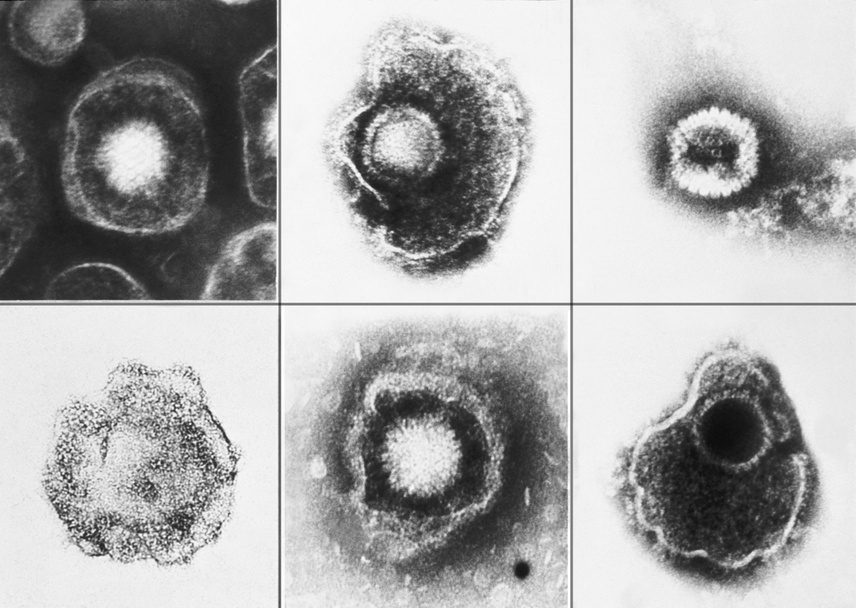 chicken pox virus under microscope