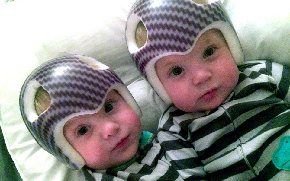 Two infants wearing matching helmets specifically designed to suit their head shape. Photo by Mitra Downes.