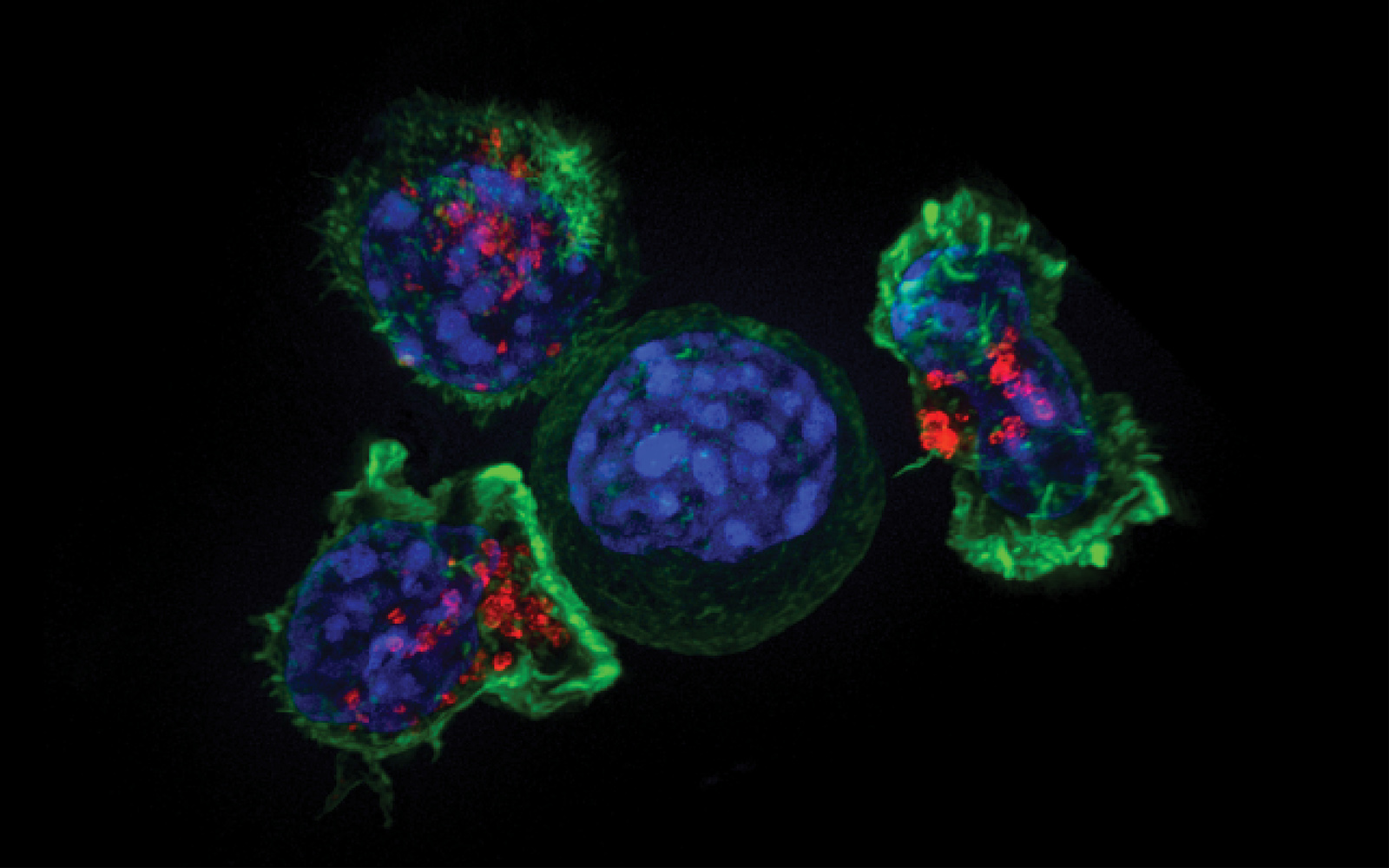 Killer T cells (green and red) surround a cancer cell (blue, center). Credit: NIH