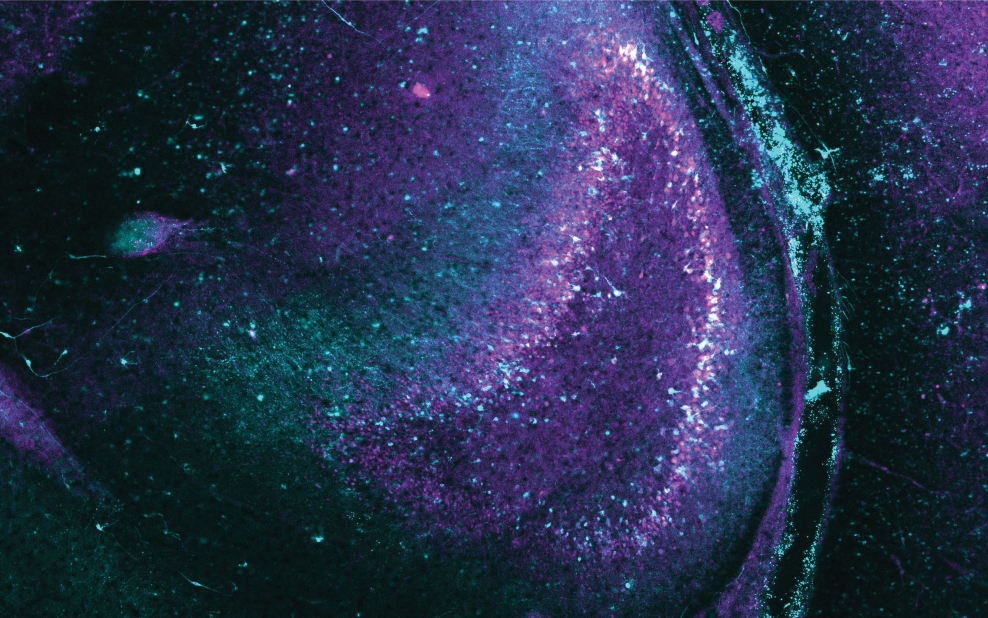 Brain tissue containing light-sensitive proteins.