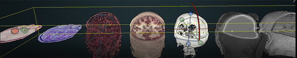 Series of representations of the brain showing different sets of data.