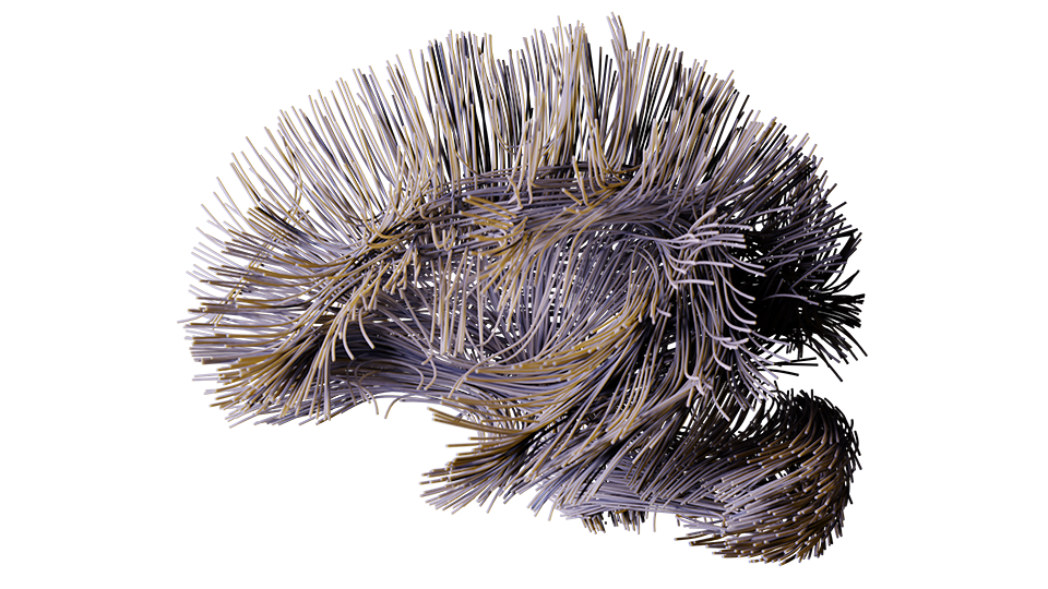 3D render of white matter tracts